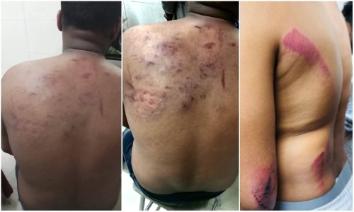 Protests, attacks on Jatiya Nagorik Party workers in Mirpur
